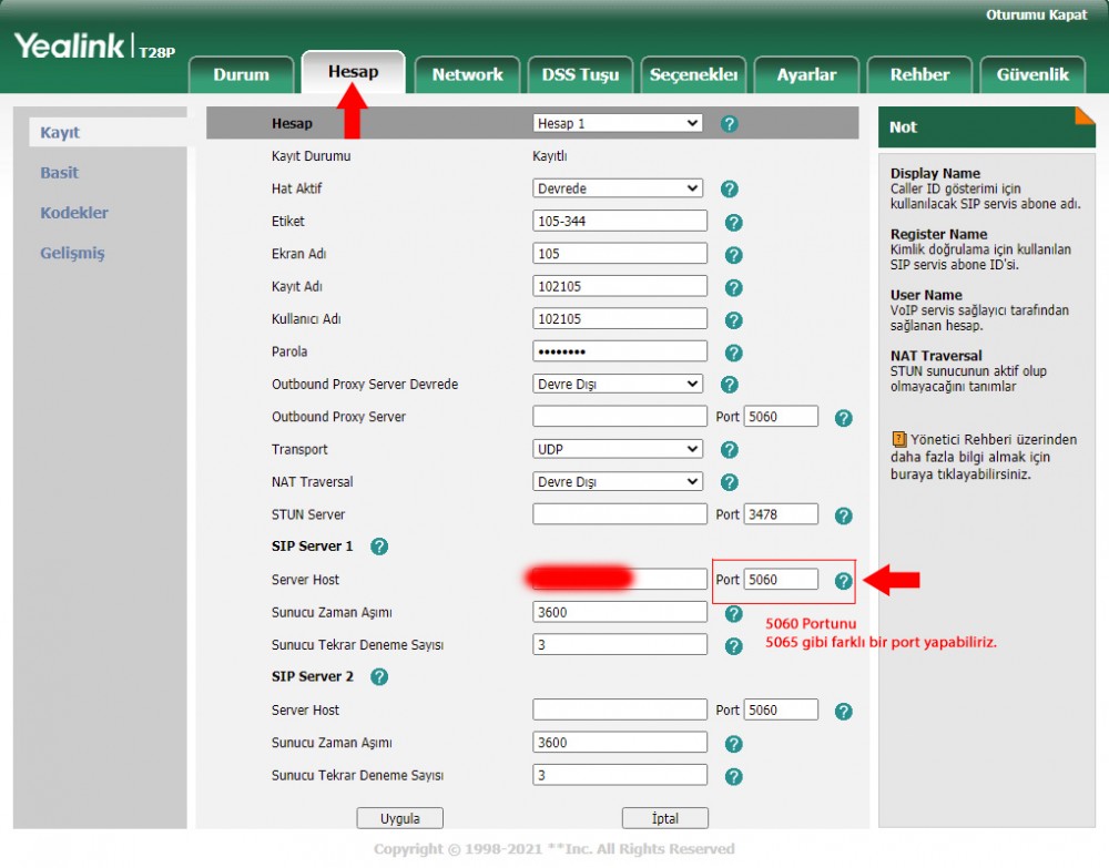 Yealink Sahte Çağrıları Engelleme -